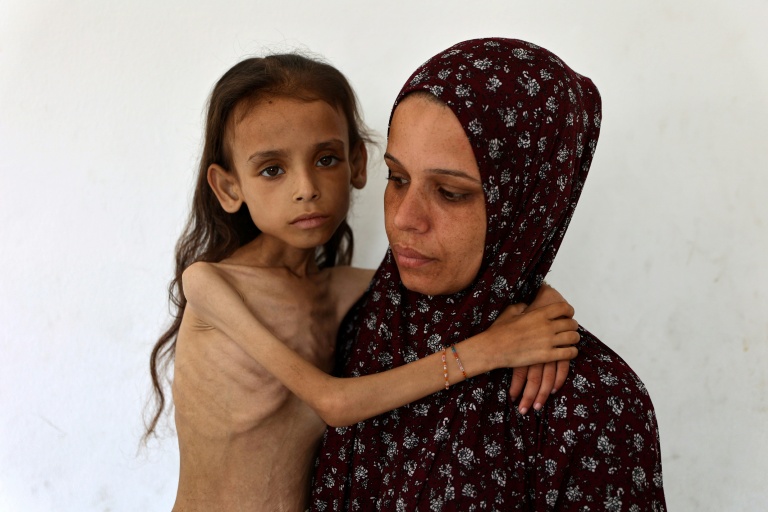 Photo prise le 2 août 2025 d'une fillette palestinienne de neuf ans souffrant de malnutrition, Mariam Dawwas, portée par sa mère, Modallala, dans le quartier de Rimal dans la ville de Gaza.