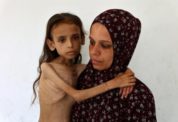 Photo prise le 2 août 2025 d'une fillette palestinienne de neuf ans souffrant de malnutrition, Mariam Dawwas, portée par sa mère, Modallala, dans le quartier de Rimal dans la ville de Gaza.