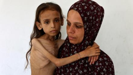 Photo prise le 2 août 2025 d'une fillette palestinienne de neuf ans souffrant de malnutrition, Mariam Dawwas, portée par sa mère, Modallala, dans le quartier de Rimal dans la ville de Gaza.