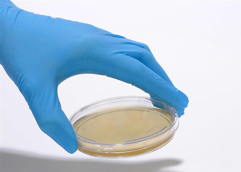 bioMérieux lance SMARTBIOME