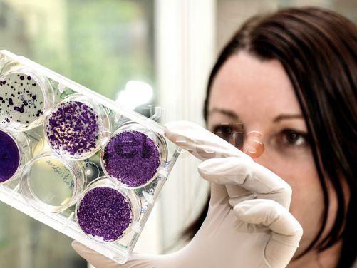Cellectis reçoit le statut RMAT de la FDA pour lasmé-cel, la première thérapie CAR-T allogénique en essai pivot pour les patients atteints de LLA-B en rechute ou réfractaire