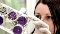 Cellectis reçoit le statut RMAT de la FDA pour lasmé-cel, la première thérapie CAR-T allogénique en essai pivot pour les patients atteints de LLA-B en rechute ou réfractaire